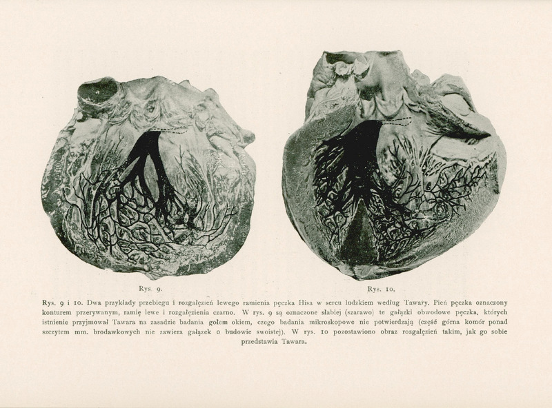 Strona zawiera dwie ilustracje anatomiczne oznaczone jako Rys. 9 i Rys. 10, przedstawiające przebieg i rozgałęzienia lewego ramienia pęczka Hisa w sercu ludzkim, według badań Tawary.
Rysunek 9 przedstawia schematyczny obraz serca z zaznaczonym pęczkiem Hisa. Pień pęczka oznaczony jest konturem przerywanym, natomiast lewe ramię i jego rozgałęzienia są zaznaczone czarnym kolorem. Dodatkowo, widoczne są słabiej zaznaczone (szarawo) gałązki obwodowe, których istnienie Tawara postulował na podstawie obserwacji makroskopowej, ale które nie zostały potwierdzone mikroskopowo. Gałązki te znajdują się w górnej części komór, ponad szczytem mięśni brodawkowych, i nie wykazują swoistej budowy.
Rysunek 10 przedstawia alternatywny obraz rozgałęzień lewego ramienia pęczka Hisa, zgodny z wyobrażeniem Tawary. Gałązki są wyraźnie zaznaczone, bez elementów szarawych – obraz jest bardziej uproszczony i idealizowany.
Oba rysunki są czarno-białe, wykonane w stylu technicznym, bez kolorów ani ozdobników. Tło strony jest jednolicie białe. Opisy są umieszczone poniżej ilustracji, zapisane prostą czcionką szeryfową, dobrze kontrastującą z tłem.
