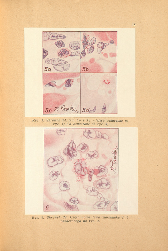 Kolorowa ilustracja w kształcie kwadratu, podzielonego na 4 części podpisane 5a, 5b, 5c i 5d. Na każdej widoczne struktury o różnych kształtach, ułożone na powierzchni. Kolorowa ilustracja podpisane ryc. 6 w kształcie kwadratu, na całej powierzchni owalne i podłużne struktury ułożone ku środkowi.