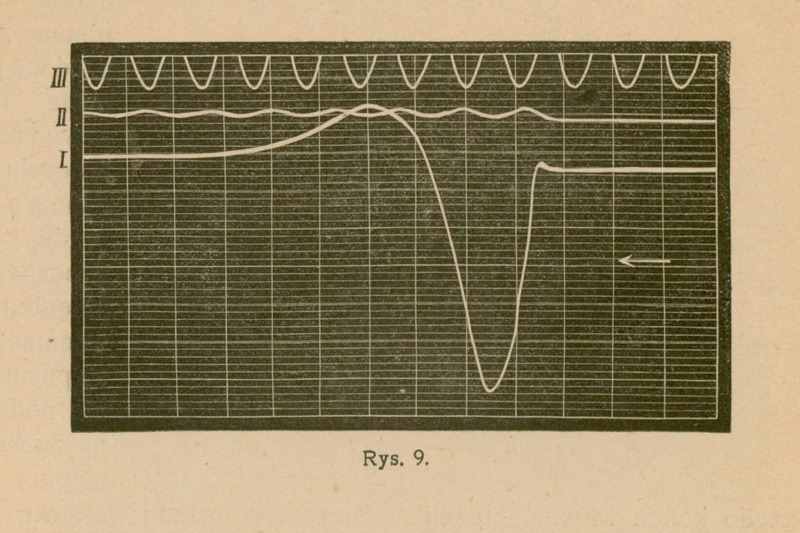 Rys. 9: wykres z trzema poziomymi liniami oznaczonymi I, II, III oraz wykreśloną krzywą przedstawiającą zmiany potencjału elektrycznego w czasie w komórce pobudzonej. Krzywa gwałtownie opada i powraca do stanu początkowego, ilustrując przejście przez fazę depolaryzacji i repolaryzacji.