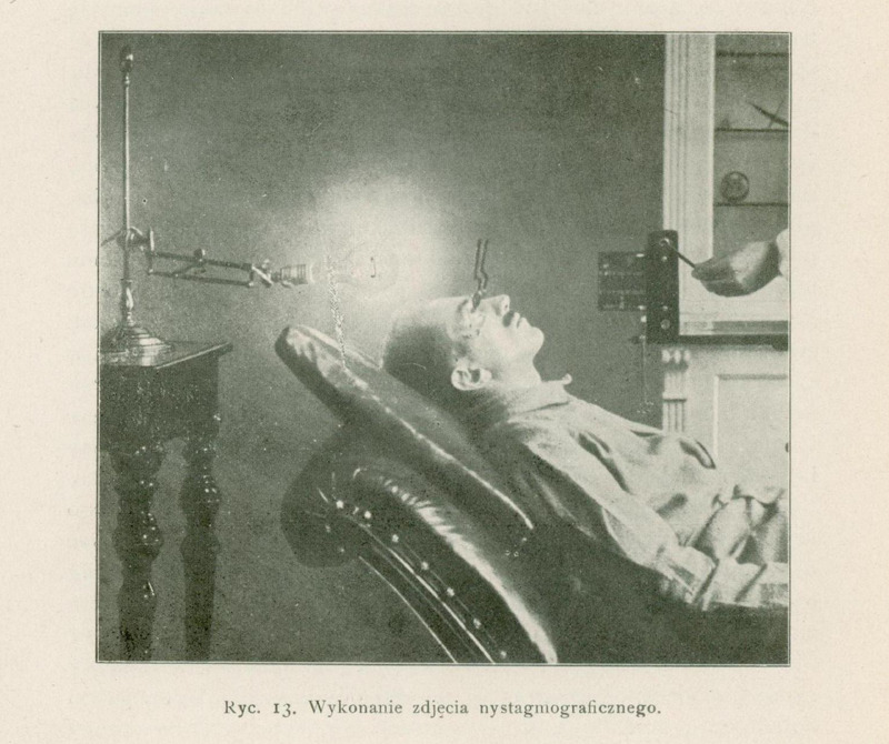 Zdjęcie przedstawia scenę związaną z wykonaniem zdjęcia nystagmograficznego, czyli badania ruchów gałek ocznych.
Widać na nim mężczyznę w średnim wieku, leżącego na odchylonym do tyłu fotelu, podobnym do fotela dentystycznego. Głowa pacjenta jest lekko odchylona do tyłu i unieruchomiona. Ma on na twarzy założone nasadki oczne, do których przymocowane są dwa cienkie pręciki (po jednym przed każdą gałką oczną).
Z lewej strony zdjęcia znajduje się lampa na wysokim statywie, skierowana bezpośrednio na oczy pacjenta — jej światło służy do tworzenia cieni pręcików na szczelinie światła lub filmie. Po prawej stronie widoczna jest ręka osoby (prawdopodobnie lekarza), która obsługuje urządzenie.
Tło zdjęcia stanowi wnętrze pomieszczenia — być może jest to gabinet okulistyczny lub laboratorium.