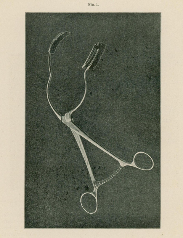 Ilustracja przedstawia pojedyncze metalowe narzędzie chirurgiczne o charakterze kleszczy. Ma długie ramiona zakończone okrągłymi uchwytami oraz szerokie, zakrzywione końcówki robocze przeznaczone do podtrzymywania lub rozszerzania tkanek. Obiekt ukazano na ciemnym, jednolitym tle.