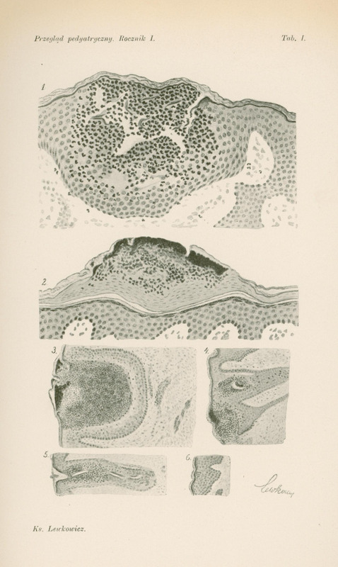 Czarno-biały rysunek podzielony na sześć części przedstawiający krostkę prosówki. 