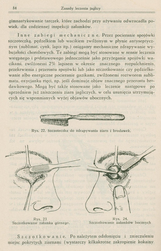 Skan ilustracji zawiera trzy rysunki. Pierwszy to szczoteczka do zdrapywania ziarn i brodawek:
Przedstawia prostą, wąską szczoteczkę z rączką przypominającą klasyczną szczoteczkę do zębów. Główka jest mała i płaska, z krótkim, gęstym włosiem.
Drugi rysunek przedstawia szczotkowanie załamka górnego:
Pokazany jest profil ludzkiej twarzy, skoncentrowany na oku. Mała szczoteczka przykładana jest do górnej wewnętrznej części powieki (czyli górnego załamka spojówki). Powieka jest wywinięta, aby umożliwić dostęp do jej wnętrza, a narzędzie lekarskie ostrożnie ją czyści.
Trzeci rysunek przedstawia szczotkowanie załamków bocznych:
Rysunek pokazuje oko od przodu. Jedna ręka trzyma powiekę w wywiniętej pozycji, druga używa szczoteczki do oczyszczania bocznej części spojówki (czyli załamka przy wewnętrznym kąciku oka).