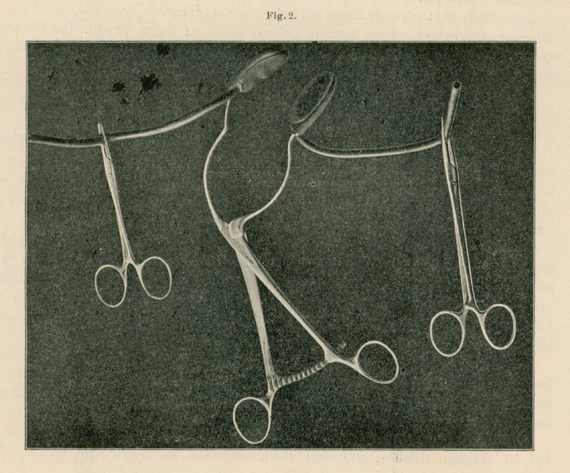 Ilustracja przedstawia 3 metalowe narzędzia chirurgiczne. Widać kilka rodzajów kleszczy i zacisków z charakterystycznymi okrągłymi uchwytami, połączonych elastycznymi przewodami lub rurkami. Narzędzia są rozmieszczone symetrycznie