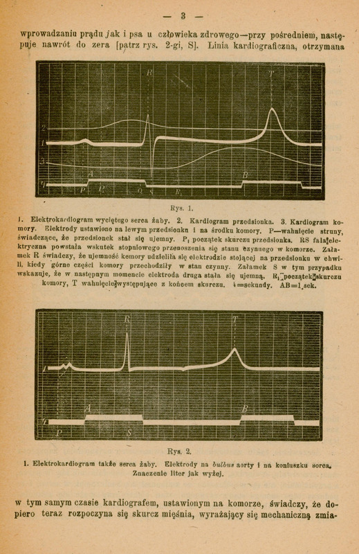 Strona pochodzi z historycznego tekstu medycznego napisanego po polsku. Zawiera dwa wykresy przedstawiające elektrodiagramy serca żaby, oznaczone jako Rys. 1 i Rys. 2.
Rys. 1: Trzy nakładające się krzywe przedstawiające:
1. Elektrokardiogram wyciętego serca żaby,
2. Kardiogram przedsionka,
3. Kardiogram komory.
Wykres opisany jest literami (P, P₁, R, S, T) oznaczającymi różne fazy aktywności elektrycznej serca. Dodatkowo zaznaczono odcinki czasu (AB = 1 sekunda). Tekst pod wykresem tłumaczy znaczenie poszczególnych załamków i ich związek z aktywnością przedsionków i komór serca.
Rys. 2: Kolejny elektrokardiogram serca żaby, z elektrodami umieszczonymi na bulbusie aorty i na koniuszku serca. Opis informuje, że oznaczenia liter są takie same jak w Rys. 1.
Na górze i dole strony znajduje się tekst opisujący eksperyment i interpretację wyników. Pismo ma charakter naukowy i medyczny, używa terminologii z zakresu fizjologii serca i elektrokardiografii.
Papier ma pożółkły odcień, wskazujący na wiek dokumentu.