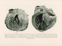 Strona zawiera dwie ilustracje anatomiczne oznaczone jako Rys. 9 i Rys. 10, przedstawiające przebieg i rozgałęzienia lewego ramienia pęczka Hisa w sercu ludzkim, według badań Tawary.
Rysunek 9 przedstawia schematyczny obraz serca z zaznaczonym pęczkiem Hisa. Pień pęczka oznaczony jest konturem przerywanym, natomiast lewe ramię i jego rozgałęzienia są zaznaczone czarnym kolorem. Dodatkowo, widoczne są słabiej zaznaczone (szarawo) gałązki obwodowe, których istnienie Tawara postulował na podstawie obserwacji makroskopowej, ale które nie zostały potwierdzone mikroskopowo. Gałązki te znajdują się w górnej części komór, ponad szczytem mięśni brodawkowych, i nie wykazują swoistej budowy.
Rysunek 10 przedstawia alternatywny obraz rozgałęzień lewego ramienia pęczka Hisa, zgodny z wyobrażeniem Tawary. Gałązki są wyraźnie zaznaczone, bez elementów szarawych – obraz jest bardziej uproszczony i idealizowany.
Oba rysunki są czarno-białe, wykonane w stylu technicznym, bez kolorów ani ozdobników. Tło strony jest jednolicie białe. Opisy są umieszczone poniżej ilustracji, zapisane prostą czcionką szeryfową, dobrze kontrastującą z tłem.

