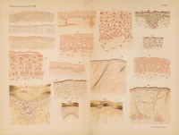 Na ilustracji znajduje się rozkładana dwustronicowa plansza przedstawiająca różne przekroje histologiczne – fragmenty tkanek w powiększeniu mikroskopowym. Całość zajmuje całą rozpiętość rozłożonej książki lub atlasu medycznego. Układ składa się z czterech rzędów i czterech kolumn, czyli łącznie 16 obrazów mikroskopowych 
Każdy rysunek to przekrój warstw komórek – rysunki stylizowane, w odcieniach różnego nasycenia – beżowo brązowych i łososiowo czerwonych tonów. Widać regularne układy komórek - warstwy o różnej gęstości i strukturze, czasem z widocznymi wypukłościami, zagłębieniami, a także włóknistymi strukturami (np. pasma w dolnych partiach). Każdy obraz jest opisany numerem (w dolnej części rysunku).
Komórki są przedstawione jako wielościenne kształty – zwykle owalne lub wielokątne – z wyraźnymi jądrami. Niektóre modele przedstawiają warstwy nabłonkowe z komórkami gładko poukładanymi, inne pokazują bardziej pofałdowaną strukturę z wypustkami i fałdami, przypominając narastającą brodawkę lub zagłębienie.
Całość wygląda jak stara litografia edukacyjna z XIX–XX w., zawierająca ręcznie kolorowane fragmenty.
Tematem opracowania jest rozwój naskórka embrionalny i u płodu donoszonego, a szczególną uwagę autor poświęca warstwie Malpighiego — czyli połączonej warstwie podstawnej i kolczystej, będącej miejscem intensywnych podziałów komórkowych.