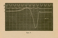 Rys. 9: wykres z trzema poziomymi liniami oznaczonymi I, II, III oraz wykreśloną krzywą przedstawiającą zmiany potencjału elektrycznego w czasie w komórce pobudzonej. Krzywa gwałtownie opada i powraca do stanu początkowego, ilustrując przejście przez fazę depolaryzacji i repolaryzacji.
