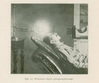 Zdjęcie przedstawia scenę związaną z wykonaniem zdjęcia nystagmograficznego, czyli badania ruchów gałek ocznych.
Widać na nim mężczyznę w średnim wieku, leżącego na odchylonym do tyłu fotelu, podobnym do fotela dentystycznego. Głowa pacjenta jest lekko odchylona do tyłu i unieruchomiona. Ma on na twarzy założone nasadki oczne, do których przymocowane są dwa cienkie pręciki (po jednym przed każdą gałką oczną). 
Z lewej strony zdjęcia znajduje się lampa na wysokim statywie,  skierowana bezpośrednio na oczy pacjenta — jej światło służy do tworzenia cieni pręcików na szczelinie światła lub filmie. Po prawej stronie widoczna jest ręka osoby (prawdopodobnie lekarza), która obsługuje urządzenie.
Tło zdjęcia stanowi wnętrze pomieszczenia — być może jest to gabinet okulistyczny lub laboratorium.