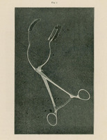 Ilustracja przedstawia pojedyncze metalowe narzędzie chirurgiczne o charakterze kleszczy. Ma długie ramiona zakończone okrągłymi uchwytami oraz szerokie, zakrzywione końcówki robocze przeznaczone do podtrzymywania lub rozszerzania tkanek. Obiekt ukazano na ciemnym, jednolitym tle.