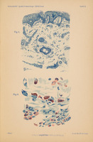 Obraz przedstawia dwa szczegółowe rysunki mikroskopowe (Fig. 3 i Fig. 4) z pracy W. Reissa „Über Urticaria pigmentosa perstans” (Hamburg 1903)
Rysunek oznaczony jako Fig. 3 przedstawia 
fragment skóry wraz z włosem wyrastającym z mieszka włosowego (tzw. cebulką).
Na samej górze widoczna jest cienka warstwa naskórka w postaci zwartego, ciemnego układu komórek, ułożonych warstwowo.
Pod naskórkiem znajdują się struktury skóry właściwej. W środku i nieco poniżej przebija się owalna struktura mieszek włosowy.
Całość jest narysowana odcieniami niebieskiego, struktury tła i przestrzenie międzykomórkowe są jasnoniebieskie, a komórki i jądra silniej nasycone barwą.
Rysunek oznaczony jako Fig. 4 przedstawia komórki tuczne (mastocyty) uwidocznione dzięki metodzie immersji i barwieniu błękitem metylenowym.
Komórki rozmieszczone są nieregularnie, w grupach lub luźnych skupiskach, na tle drobnego, jasnego tła.
Każda komórka ma charakterystyczny owalny lub spłaszczony kształt z gęstym, ziarnistym wypełnieniem – w wielu z nich widać wyraźne, grudkowate ziarna, zaznaczone ciemniejszym niebieskim lub czerwonawym tonem. Niektóre komórki mają wyraźne jądro. Część ma kształt serca lub łezki. 
Barwienie sprawia, że ziarnistości dają czerwony punktowy akcent na tle jasnoniebieskiej cytoplazmy.
Komórki są różnej wielkości – od drobnych po większe z dużą ilością ziaren.