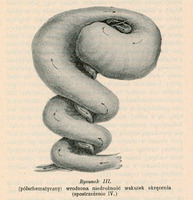 Ilustracja półschematyczna oznaczona jako „Rysunek III” przedstawia przypadek wrodzonej niedrożności jelit spowodowanej skręceniem. Obraz pochodzi z obserwacji klinicznej oznaczonej jako „Spostrzeżenie IV”. Schemat ukazuje skręcony wokół krezki fragment jelita cienkiego, który prowadzi do mechanicznej niedrożności przewodu pokarmowego. Strzałki wskazują kierunek skrętu. Jelito idąc od dołu ku górze jest coraz bardziej rozdęte. Pod rysunkiem znajduje się podpis: „Rysunek III. (półschematyczny) wrodzona niedrożność wskutek skręcenia (spostrzeżenie IV.)” Poniżej znajduje się dalszy opis przypadku klinicznego oraz podpisy autorów: Dr S. Ciechanowski i Dr L. K. Gliński.

Papier ma pożółkły odcień, wskazujący na wiek dokumentu.

