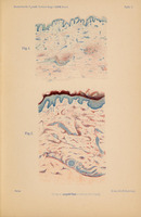 Poniżej znajduje się rozszerzony opis ilustracji z publikacji Władysława Reissa „Über Urticaria pigmentosa perstans” (Hamburg, 1903). 
Plansza zawiera dwa rysunki opisane jako „Fig. 1” (u góry) i „Fig. 2” (niżej) – umieszczone na jasnym papierze.
Nad rysunkami widoczne są nagłówki: Monatshefte f. prakt. Dermatologie XXXVII. Band oraz Tafel I.
Na dole strony drobnym drukiem: nazwisko Reiss, wydawnictwo Verlag von Leopold Voss in Hamburg (und Leipzig), oraz litografia: Lith. Anst. Julius Klinkhardt, Leipzig.
Rysunek górny przedstawia schemat mikroskopowy górnej warstwy skóry – cienka warstwa naskórka i powierzchniowa skóra właściwa. Naskórek koloru niebieskiego, oddzielony od warstwy podskórnej bardzo delikatnymi pasmami włóknistymi lub płynowymi. Warstwy skóry właściwej przedstawione jako niemal jednolita, delikatna tekstura o drobnych punkcikach i falach koloru różowego.
Rysunek dolny znacznie większy przedstawia bardziej zaawansowaną formę chorobową.
U góry gęstsza warstwa kolczystego i ziarnistego naskórka w kolorze granatowo-niebieskim, z widocznym ciemniejszym paskiem rogowej warstwy (mniej regularnie falującej).
Poniżej obszar skóry właściwej w odcieniach łososiowo-czerwonych z intensywnymi plamkami i mniejszymi skupiskami punktów – to prawdopodobnie mastocyty (komórki tuczne) rozproszone wśród tkanki.
Dodatkowo w dolnej części widoczne spiralne lub kuliste formy – mogą to być przekroje struktur gruczołów lub skupisk komórkowych.
Cały rysunek wykonany z dużą precyzją i artystyczną dbałością o różnorodność strukturalną.