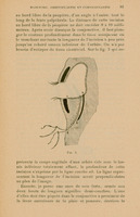 Skan ilustracji przedstawia schematyczny, anatomiczny przekrój przez oczodół człowieka — w widoku z boku. Obraz ma na celu pokazanie techniki chirurgicznej stosowanej w zabiegu orbitoplastyki i fornikoplastyki, czyli rekonstrukcji oczodołu i fałdu spojówkowego. Centralną część rysunku stanowi pusta przestrzeń oczodołu (miejsce, gdzie normalnie znajdowałaby się gałka oczna), otoczona przez struktury tkanek miękkich. Skan ilustracji przedstawia schematyczny, anatomiczny przekrój przez oczodół człowieka — w widoku z boku. Obraz ma na celu pokazanie techniki chirurgicznej stosowanej w zabiegu orbitoplastyki i fornikoplastyki, czyli rekonstrukcji oczodołu i fałdu spojówkowego.
________________________________________
Centralną część rysunku stanowi pusta przestrzeń oczodołu (miejsce, gdzie normalnie znajdowałaby się gałka oczna), otoczona przez struktury tkanek miękkich.
Górna i dolna powieka są przedstawione jako zakrzywione linie z małymi zaznaczeniami rzęs, co wskazuje ich zewnętrzne brzegi.
Wewnątrz rysunku przebiegają trzy oznaczone punkty i linie:
Punkt a i punkt b są połączone zakrzywioną linią, która reprezentuje głębokość nacięcia w obrębie spojówki i tkanek oczodołu.
Punkt c i punkt d pokazują przebieg nici chirurgicznej, która została wprowadzona w ramach zabiegu — linia od c do d biegnie przez dolną część oczodołu.
Całość ukazuje sytuację po usunięciu gałki ocznej, gdzie dąży się do odbudowy przestrzeni oczodołowej pod przyszłą protezę oka.