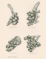 Skan przedstawia cztery monochromatyczne ilustracje. Ilustracja w lewym górnym rogu ukazuje strukturę złożoną z wielu komórek o różnych kształtach, połączonych w większe skupiska. Całość przypomina korzenie drzewa. Druga w prawym górnym rogu podobną strukturę, ale z bardziej nieregularnym układem komórek. Niektóre komórki są większe, inne mniejsze, co nadaje ilustracji bardziej dynamiczny charakter. Ilustracja w lewym dolnym rogu pokazuje strukturę o bardziej rozgałęzionej formie, z wyraźnymi przewodami lub kanałami biegnącymi między komórkami. Całość przypomina płynąca meduzę. Ilustracja w prawym dolnym rogu przedstawia strukturę z wyraźnie zaznaczonymi granicami komórek i centralnym przewodem. Komórki są duże, a ich układ bardziej geometryczny, uporządkowany. Całość przypomina kiść winogron. Na dole podany autor ilustracji: Dr. J. Baracz. 