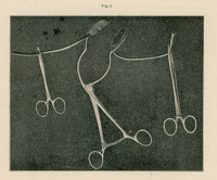 Ilustracja przedstawia 3 metalowe narzędzia chirurgiczne. Widać kilka rodzajów kleszczy i zacisków z charakterystycznymi okrągłymi uchwytami, połączonych elastycznymi przewodami lub rurkami. Narzędzia są rozmieszczone symetrycznie
