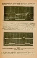 Strona pochodzi z historycznego tekstu medycznego napisanego po polsku. Zawiera dwa wykresy przedstawiające elektrodiagramy serca żaby, oznaczone jako Rys. 1 i Rys. 2.
Rys. 1: Trzy nakładające się krzywe przedstawiające:
1. Elektrokardiogram wyciętego serca żaby,
2. Kardiogram przedsionka,
3. Kardiogram komory.
Wykres opisany jest literami (P, P₁, R, S, T) oznaczającymi różne fazy aktywności elektrycznej serca. Dodatkowo zaznaczono odcinki czasu (AB = 1 sekunda). Tekst pod wykresem tłumaczy znaczenie poszczególnych załamków i ich związek z aktywnością przedsionków i komór serca.
Rys. 2: Kolejny elektrokardiogram serca żaby, z elektrodami umieszczonymi na bulbusie aorty i na koniuszku serca. Opis informuje, że oznaczenia liter są takie same jak w Rys. 1.
Na górze i dole strony znajduje się tekst opisujący eksperyment i interpretację wyników. Pismo ma charakter naukowy i medyczny, używa terminologii z zakresu fizjologii serca i elektrokardiografii.
Papier ma pożółkły odcień, wskazujący na wiek dokumentu.