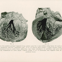 Strona zawiera dwie ilustracje anatomiczne oznaczone jako Rys. 9 i Rys. 10, przedstawiające przebieg i rozgałęzienia lewego ramienia pęczka Hisa w sercu ludzkim, według badań Tawary.
Rysunek 9 przedstawia schematyczny obraz serca z zaznaczonym pęczkiem Hisa. Pień pęczka oznaczony jest konturem przerywanym, natomiast lewe ramię i jego rozgałęzienia są zaznaczone czarnym kolorem. Dodatkowo, widoczne są słabiej zaznaczone (szarawo) gałązki obwodowe, których istnienie Tawara postulował na podstawie obserwacji makroskopowej, ale które nie zostały potwierdzone mikroskopowo. Gałązki te znajdują się w górnej części komór, ponad szczytem mięśni brodawkowych, i nie wykazują swoistej budowy.
Rysunek 10 przedstawia alternatywny obraz rozgałęzień lewego ramienia pęczka Hisa, zgodny z wyobrażeniem Tawary. Gałązki są wyraźnie zaznaczone, bez elementów szarawych – obraz jest bardziej uproszczony i idealizowany.
Oba rysunki są czarno-białe, wykonane w stylu technicznym, bez kolorów ani ozdobników. Tło strony jest jednolicie białe. Opisy są umieszczone poniżej ilustracji, zapisane prostą czcionką szeryfową, dobrze kontrastującą z tłem.

