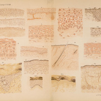 Na ilustracji znajduje się rozkładana dwustronicowa plansza przedstawiająca różne przekroje histologiczne – fragmenty tkanek w powiększeniu mikroskopowym. Całość zajmuje całą rozpiętość rozłożonej książki lub atlasu medycznego. Układ składa się z czterech rzędów i czterech kolumn, czyli łącznie 16 obrazów mikroskopowych 
Każdy rysunek to przekrój warstw komórek – rysunki stylizowane, w odcieniach różnego nasycenia – beżowo brązowych i łososiowo czerwonych tonów. Widać regularne układy komórek - warstwy o różnej gęstości i strukturze, czasem z widocznymi wypukłościami, zagłębieniami, a także włóknistymi strukturami (np. pasma w dolnych partiach). Każdy obraz jest opisany numerem (w dolnej części rysunku).
Komórki są przedstawione jako wielościenne kształty – zwykle owalne lub wielokątne – z wyraźnymi jądrami. Niektóre modele przedstawiają warstwy nabłonkowe z komórkami gładko poukładanymi, inne pokazują bardziej pofałdowaną strukturę z wypustkami i fałdami, przypominając narastającą brodawkę lub zagłębienie.
Całość wygląda jak stara litografia edukacyjna z XIX–XX w., zawierająca ręcznie kolorowane fragmenty.
Tematem opracowania jest rozwój naskórka embrionalny i u płodu donoszonego, a szczególną uwagę autor poświęca warstwie Malpighiego — czyli połączonej warstwie podstawnej i kolczystej, będącej miejscem intensywnych podziałów komórkowych.