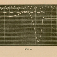 Rys. 9: wykres z trzema poziomymi liniami oznaczonymi I, II, III oraz wykreśloną krzywą przedstawiającą zmiany potencjału elektrycznego w czasie w komórce pobudzonej. Krzywa gwałtownie opada i powraca do stanu początkowego, ilustrując przejście przez fazę depolaryzacji i repolaryzacji.