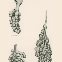 Skan przedstawia trzy monochromatyczne ilustracje. Pierwsza pokazuje dziurawą strukturę, z której wyrastają liczne małe, kuliste elementy. Druga w lewym dolnym rogu pokazuje rozgałęzioną strukturę. Przypomina rafę koralową. Trzecia ilustracja, w prawym dolnym rogu, przedstawia bardziej zwartą, wydłużoną strukturę. Struktura i kształt przypominają połówkę obranego orzecha włoskiego.