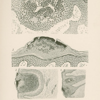 Czarno-biały rysunek podzielony na sześć części przedstawiający krostkę prosówki. 