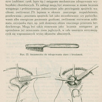 Skan ilustracji zawiera trzy rysunki. Pierwszy to szczoteczka do zdrapywania ziarn i brodawek:
Przedstawia prostą, wąską szczoteczkę z rączką przypominającą klasyczną szczoteczkę do zębów. Główka jest mała i płaska, z krótkim, gęstym włosiem.
Drugi rysunek przedstawia szczotkowanie załamka górnego:
Pokazany jest profil ludzkiej twarzy, skoncentrowany na oku. Mała szczoteczka przykładana jest do górnej wewnętrznej części powieki (czyli górnego załamka spojówki). Powieka jest wywinięta, aby umożliwić dostęp do jej wnętrza, a narzędzie lekarskie ostrożnie ją czyści.
Trzeci rysunek przedstawia szczotkowanie załamków bocznych:
Rysunek pokazuje oko od przodu. Jedna ręka trzyma powiekę w wywiniętej pozycji, druga używa szczoteczki do oczyszczania bocznej części spojówki (czyli załamka przy wewnętrznym kąciku oka).