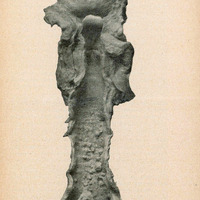 Zdjęcie preparatu, otwartej tchawicy z mnogimi zmianami nowotworowymi w postaci różnej wielkości uwypukleń błony śluzowej.